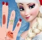 Cuidar da mão da Princesa Elsa