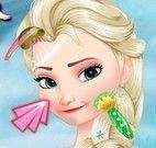 Elsa spa limpeza de pele