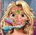 Tratamento do rosto da Rapunzel