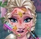 Cuidar do rosto da Elsa