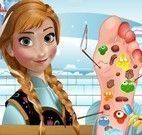 Anna Frozen cuidar do pé