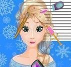Implante de cabelo da Elsa