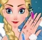 Elsa cuidar da mão