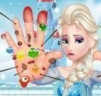 Cuidados com as mãos da Elsa