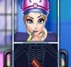 Elsa Frozen fazer cirurgia