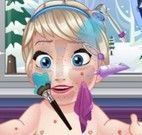 Elsa bebê limpeza facial