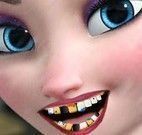 Princesa Elsa no dentista