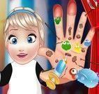 Cuidar da mão da Elsa bebê