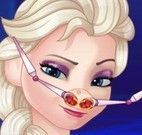 Elsa médico do nariz