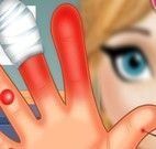 Cuidar da mão da Anna machucada