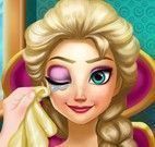 Elsa no oftalmo