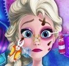 Cuidar dos machucados da Elsa