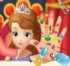 Mão da Princesa Sofia machucada