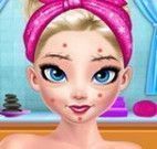 Tratamento facial da Elsa
