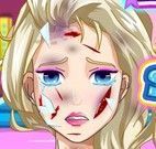 Elsa cirurgia do rosto
