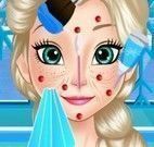 Elsa limpeza profunda facial