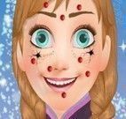 Anna Frozen limpeza de pele especial