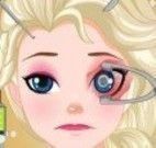Elsa cirurgia do olho