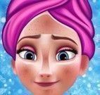 Frozen Elsa tratamento facial