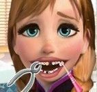 Anna Frozen dentista