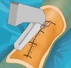 Operar o joelho do paciente